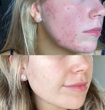 Load image into Gallery viewer, Serum of Clear