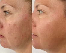 Load image into Gallery viewer, Serum of Plenty